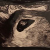 Callum 8.18.20 Miscarriage Support Fort Collins